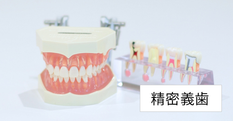 精密義歯